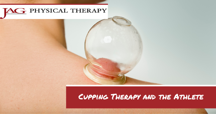 Cupping Therapy and the Athlete