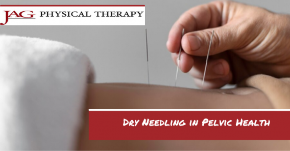 Dry Needling in Pelvic Health