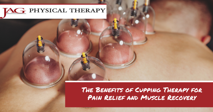 Cupping Therapy for Muscle Recovery: Boost Healing and Performance