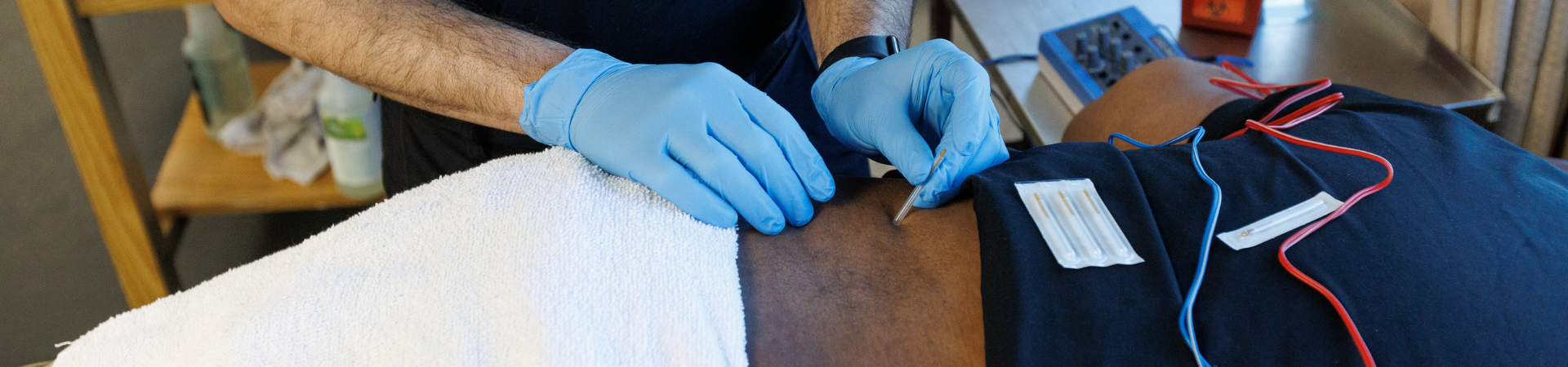 Dry Needling