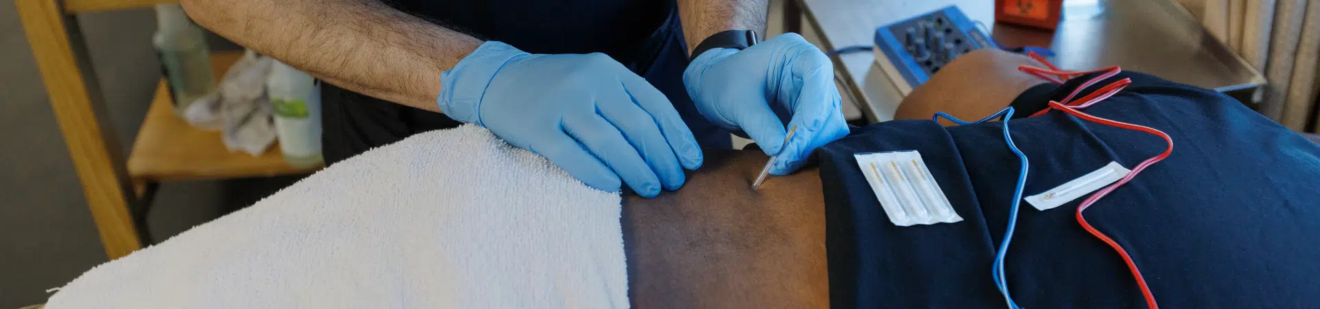 Dry-Needling