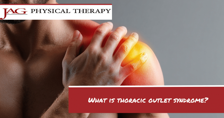 What is Thoracic Outlet Syndrome? | JAG PT